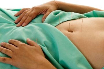 Fertility Acupuncture Aurora-Newmarket