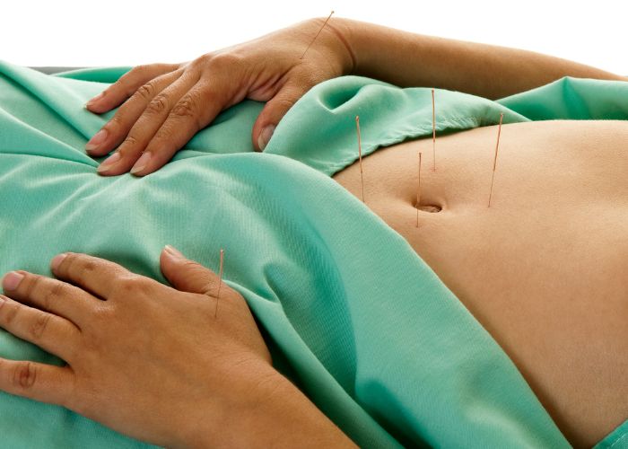 Fertility Acupuncture Aurora-Newmarket