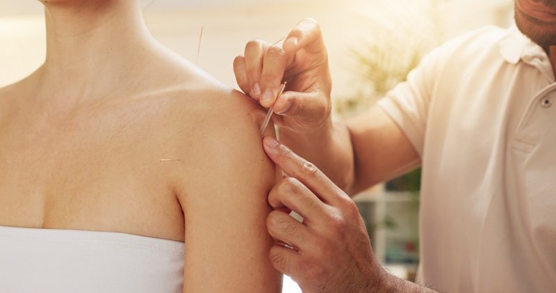 Cosmetic acupuncture in Aurora